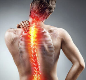 Dextroscoliosis (or) Scoliosis