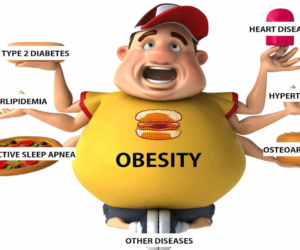 Obesity, overweightness, rotundness