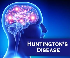 Huntington Chorea, Huntington Disease