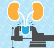 Stress Incontinence in Males (or) Overflow Incontinence