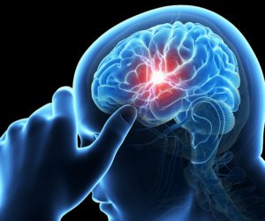 Post Stroke